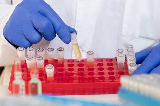 A scientist shows a laboratory stand with small test tubes from which he took out one test tube with a yellow liquid, the development of medicinal drugs.