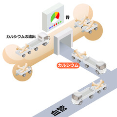 骨粗鬆症のしくみ