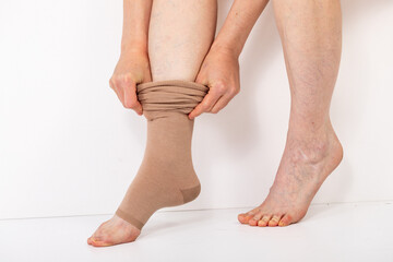 Woman putting on compression knee-highs. Mature female applying medical stocking to leg with varicose veins and dry skin. Health care for tired legs