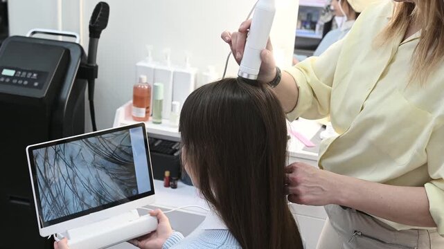 scalp examination using trichoscope reveals alopecia, dandruff and seborrhea. Specialist analyzes hair structure on monitor. Professional approach to hair diagnostics. Hair loss oily scalp