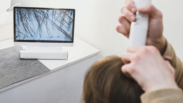 Trichologist examines hair and scalp of young woman in salon using trichoscope and dermatoscope. Woman's hair loss, dandruff and oily hair problems, scalp treatment and hair care consultations are add