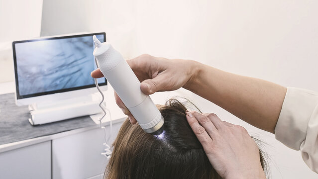 Trichologist examines hair and scalp of young woman in salon using trichoscope and dermatoscope. Woman's hair loss, dandruff and oily hair problems, scalp treatment and hair care consultations are add