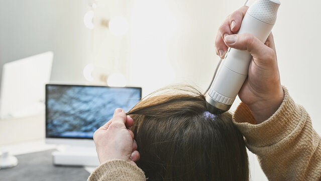 Trichologist examines hair and scalp of young woman in salon using trichoscope and dermatoscope. Woman's hair loss, dandruff and oily hair problems, scalp treatment and hair care consultations are add