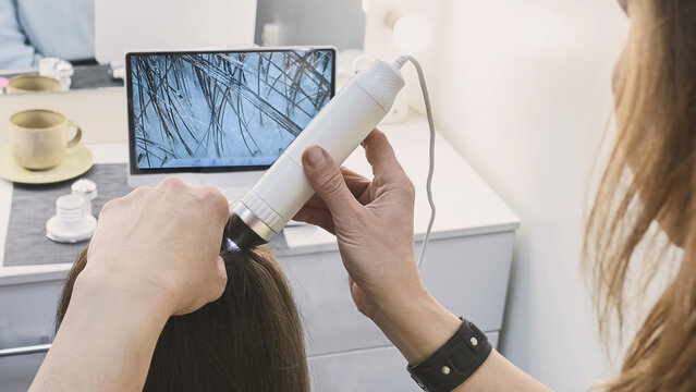 Trichologist examines hair and scalp of young woman in salon using trichoscope and dermatoscope. Woman's hair loss, dandruff and oily hair problems, scalp treatment and hair care consultations no face