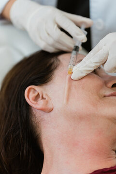 Doctor injecting prp platelet-rich plasma into woman's face