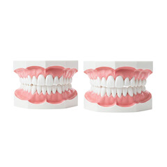 Obraz premium Dental model of human teeth and gum health