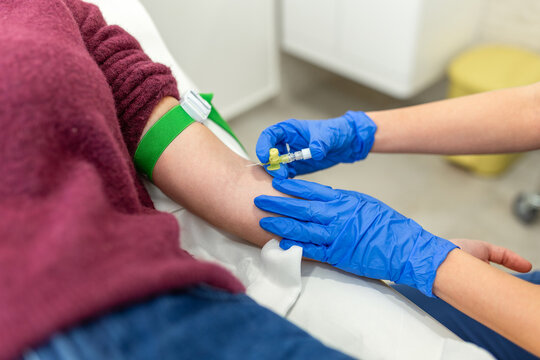 Close Up of Nurse Taking Blood Sample from Patient Arm with Needle and Catheter. Professional Medical Procedure for Laboratory Test, Blood Donation, or IV Therapy in Clinical Setting.