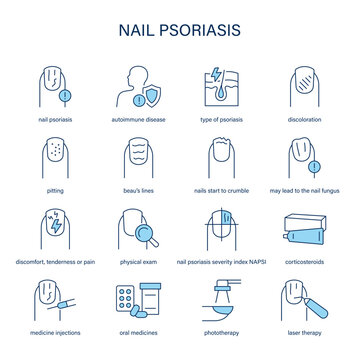 Nail Psoriasis symptoms, diagnostic and treatment vector icon set