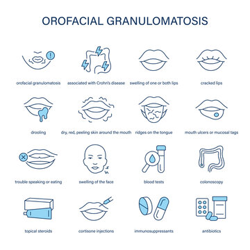 Orofacial Granulomatosis symptoms, diagnostic and treatment vector icon set