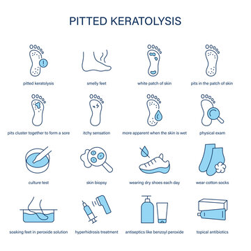 Pitted Keratolysis symptoms, diagnostic and treatment vector icon set