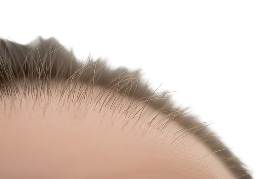 Extreme close-up of fine vellus hair on human skin with a black background