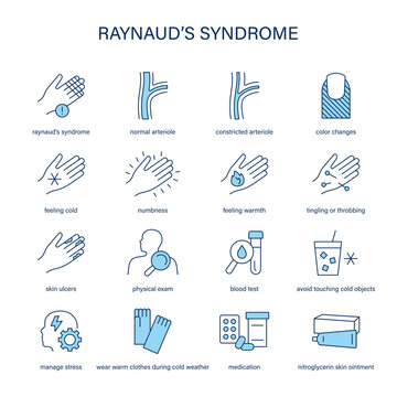Raynaud's Syndrome symptoms, diagnostic and treatment vector icon set.