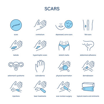 Scars symptoms, diagnostic and treatment vector icon set
