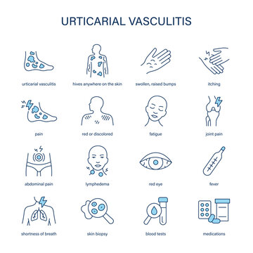 Urticarial Vasculitis symptoms, diagnostic and treatment vector icon set