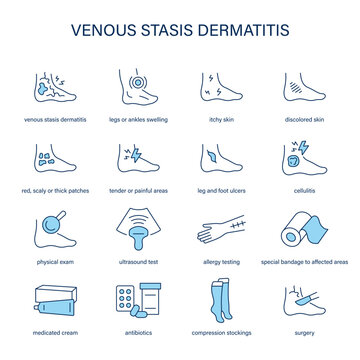 Venous Stasis Dermatitis symptoms, diagnostic and treatment vector icon set