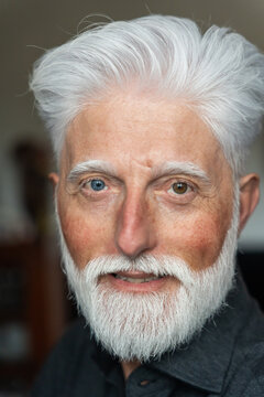 Senior Man With Heterochromatic Eyes And White Hair