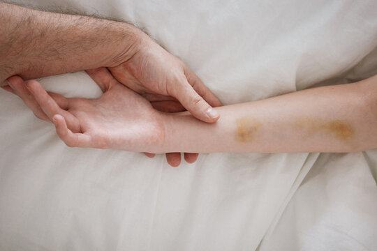 Abuse concept - Vulnerability