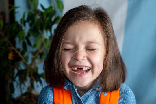 Portrait of a Laughing Girl Child Without Front Teeth