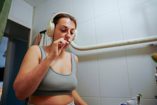 Woman with psoriasis