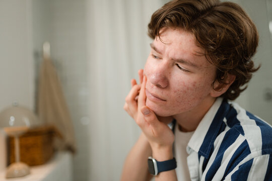 A man examines his face with pimples in the mirror