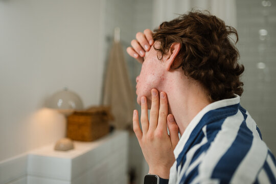 A man examines his face with pimples in the mirror