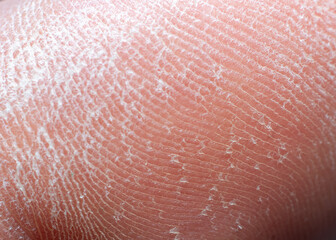Fototapeta premium Close-up drawing of human skin.