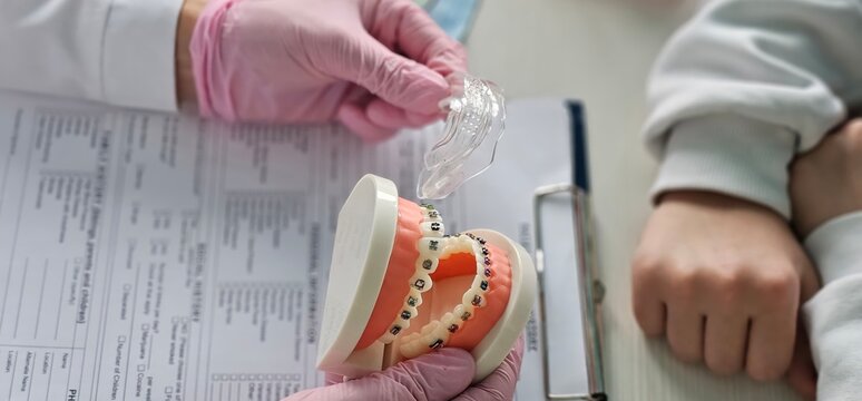 Dental explaining braces and oral care with a model during a consultation