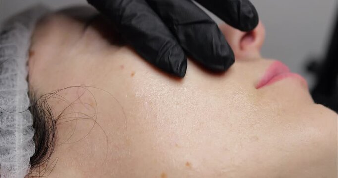 Cosmetic procedure microneedling. Facial skin with wrinkles. Restorative and rejuvenating cosmetics. Beauty salon.