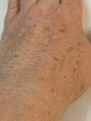 Fototapeta premium Aged White Womans Hand Closeup Showing Uncut Nails, Brown Age Spots, Pronounced Wrinkles And Visible Veins, Resting On Neutral Fabric Background Under Soft Natural Light, High Texture Detail