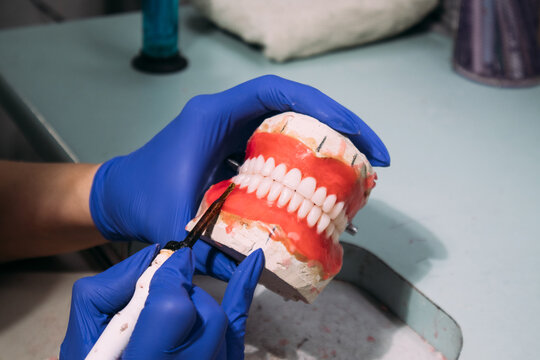 Creating wax gums on dental cast