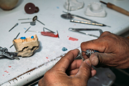Dental technician adjusting metal bridge