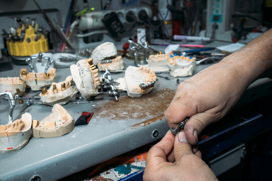 Dental technician working with crowns