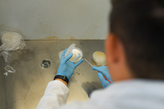 Petri dish transfer
