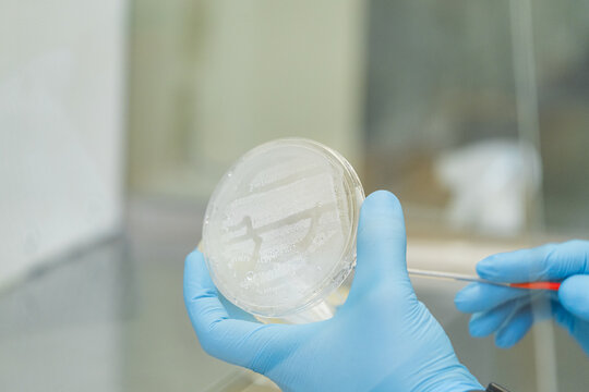 Bacterial culture in Petri dish