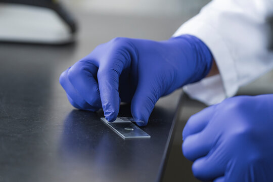 Sample mounting on glass slide
