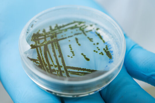 Algal culture on agar