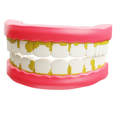 3d Illustration of Unhealthy Teeth Plaque Tartar Dental