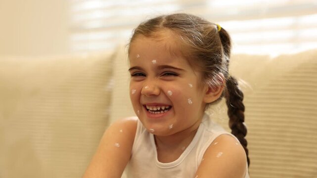 Mother applying cream onto skin of her daughter with chickenpox at home, closeup