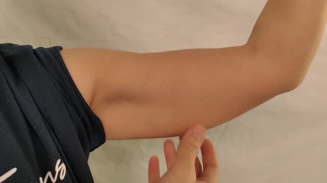 portrait the fingers holding the flabbiness adipose sagging skin, Flabby skin and loose under the arm of the woman, health care and beauty concept.