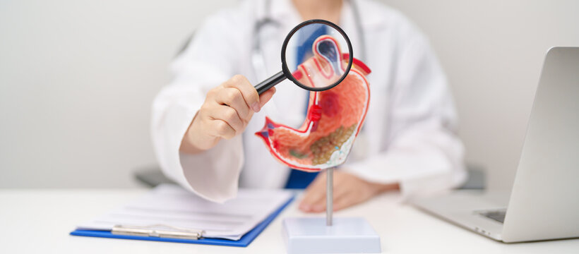 Doctor with Gastric anatomy model. Gastroenterologist consultation, stomach diseases and ulcers, November stomach cancer, Gastroesophageal Reflux Disease, GERD, Acid reflux and healthcare medical