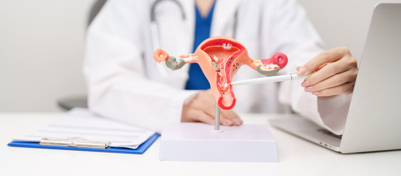 Doctor with Uterus and Ovaries anatomy model. Ovarian and Cervical cancer, Cervix disorder, Endometriosis, Hysterectomy, Uterine fibroids, Reproductive system, Pregnancy and health concept