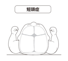 赤ちゃんが寝ている頭の向きによって頭の形に歪みが生じるメカニズム、斜頭症,短頭症,長頭症の赤ちゃんのイラスト