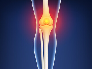 3D knee pain visualization. Leg bones with red inflammation glow at joint area. Biological and medical concept. Vector illustration