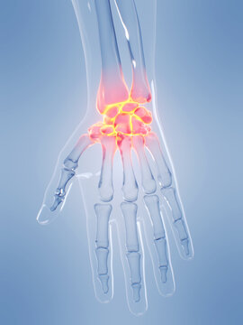 A Detailed 3D Depiction Of The Wrist Bones Of A Human Male