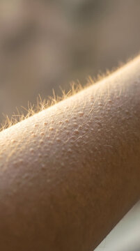Skin displays goosebumps with light reflecting on hair follicles. Arm shown in outdoor setting with warm sunlight. Concept of human emotion, reactions, sensory perception