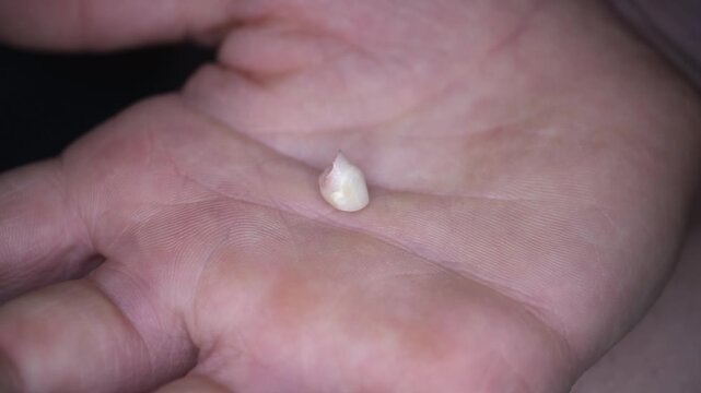 Close-up of a baby tooth in a child's palm