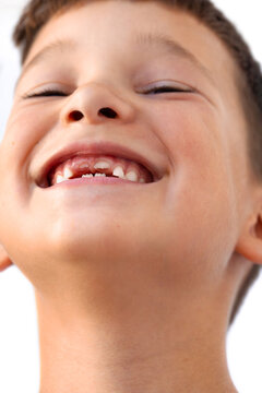 Happy Boy Showing off His Missing Teeth in a Cheerful Smile
