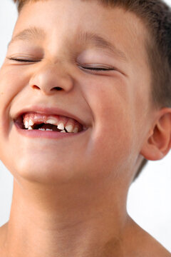 Happy Boy With Missing Teeth Smiles Joyfully in Bright Setting