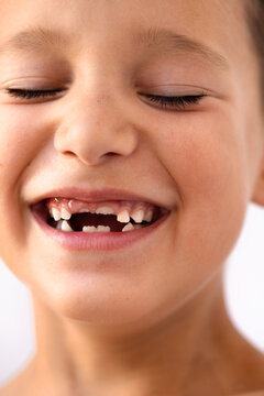 Close up of a Smiling Child With Missing Teeth