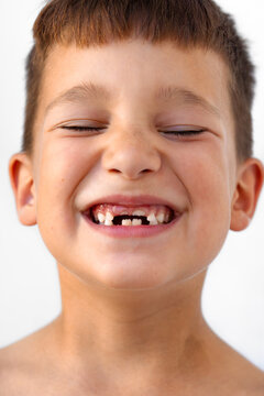 Smiling Boy With Missing Teeth